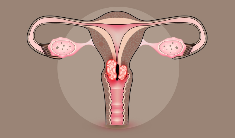 Imagem ilustrativa de um útero