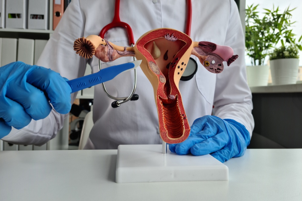 Médico apontando com bisturi para objeto representando um ovário