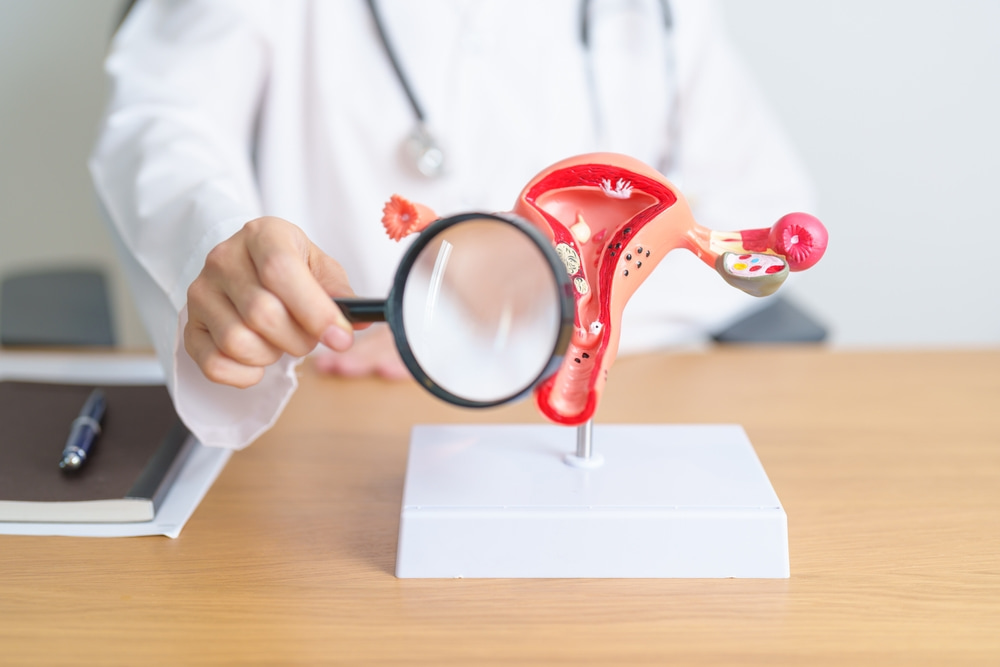 Médico usando lupa em objeto ilustrando um útero