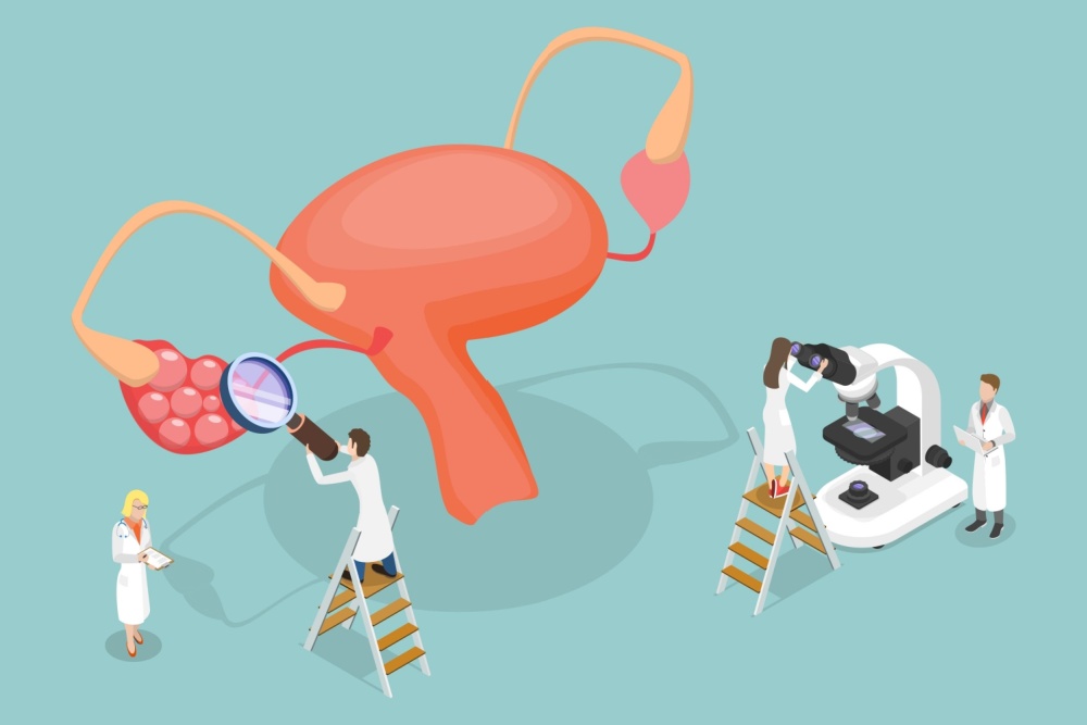 Imagem ilustrativa de um útero e médicos